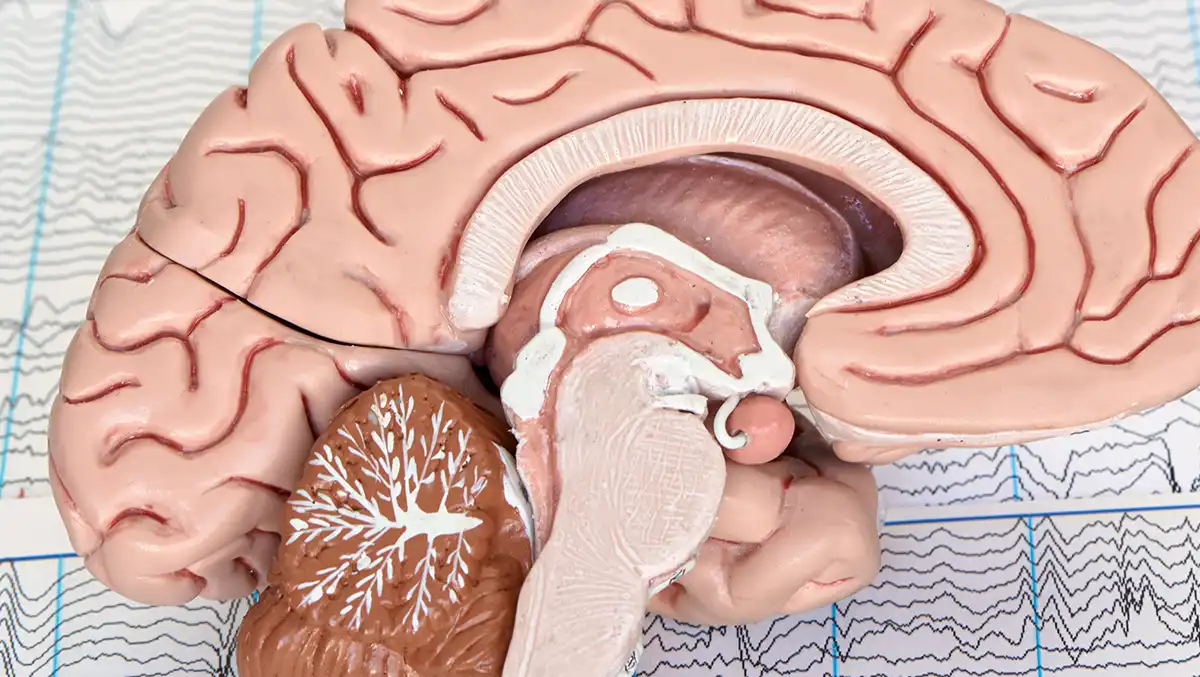 Stereoelektroenzephalographie